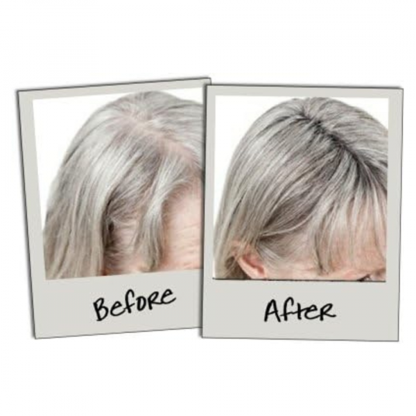 HAIRSPRAY- Liečba vypadávania vlasov – vlasové vlákna slider