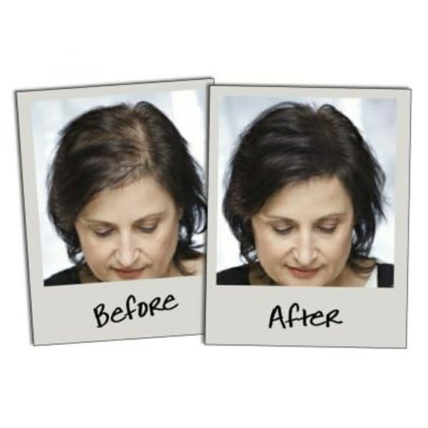 HAIRSPRAY- Liečba vypadávania vlasov – vlasové vlákna slider